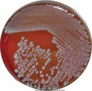 E coli