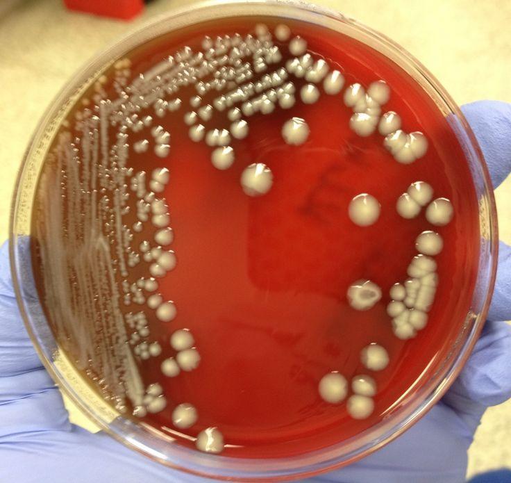 Klebsiella