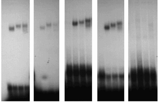 32 P- ανιχνευτής: ACO Cyp4A6z GSTA1.1 GSTA1.2 GSTA1.3 PPAR : C α β γ C α β γ C α β γ C α β γ C α β γ PPAR/mRXRβ/ DNA σύμπλοκα μη δεσμευόμενος 32 P-ανιχνευτής Εικόνα 31.