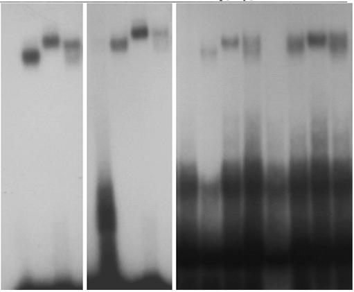 32 P- ανιχνευτής: PPAR : ACO Cyp4A6z GSTA1.1 GSTA1.2 GSTA1.3 C α β γ C α β γ C α β γ C α β γ C α β γ PPAR/mRXRβ/ DNA σύμπλοκα μη δεσμευόμενος 32 P-ανιχνευτής Εικόνα 32.