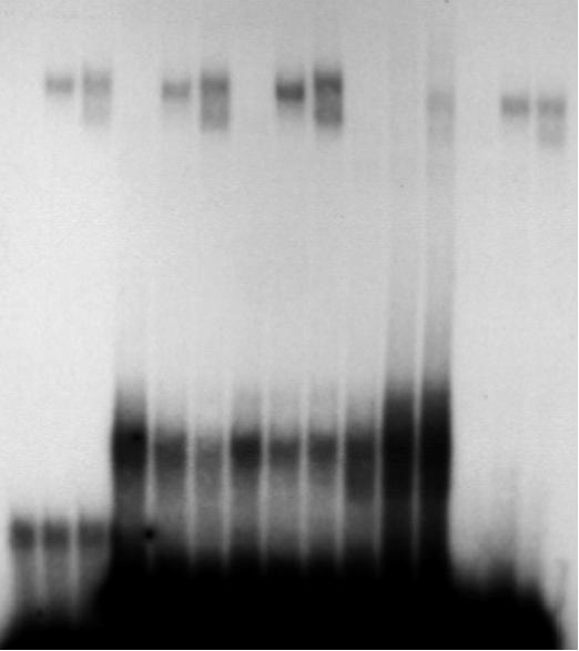 32 P- ανιχνευτής: PPAR : ACO GSTA1.1 GSTA1.2 GSTA1.3 Cyp4A6z C β γ C β γ C β γ C β γ C β γ PPAR/mRXRβ/ DNA σύμπλοκα μη δεσμευόμενος 32 P-ανιχνευτής Εικόνα 34.