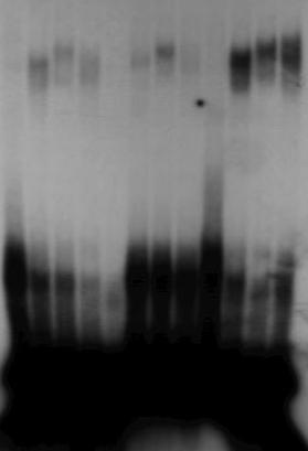 A PPAR: PPAR / PPAR mrxrβ /PpRXRα C α β α β B 32 P- ανιχνευτής: PPAR: ACO.A GSTA1.1 GSTA1.