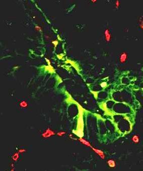 More than 5% of Secreted GLP-1 is Degraded Before Plasma Absorption GLP-1 (green) released into intestinal capillaries is immediately exposed to DPP-4 (red) 1 > 5% of secreted GLP-1 is already