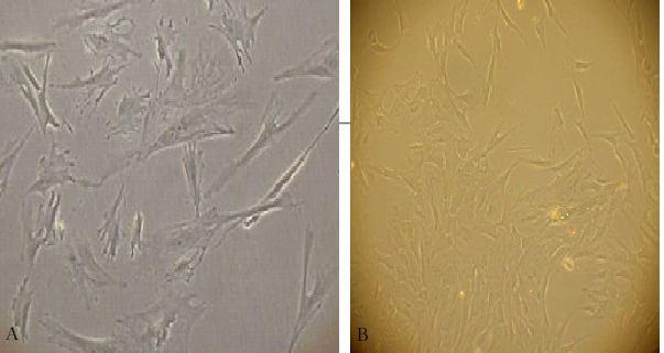 110 Εικόνα 18 Α, Β. Κύτταρα με μορφολογία ινοβλαστών ύστερα από την καλλιέργεια σε πλήρες θρεπτικό μέσο DMEM μετά από(α) 3 και (Β) 5 ημέρες αντίστοιχα.