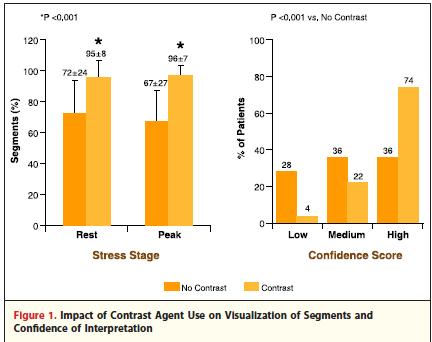 Sensitivity significantly higher for LCX (62% vs. 49% p=0.