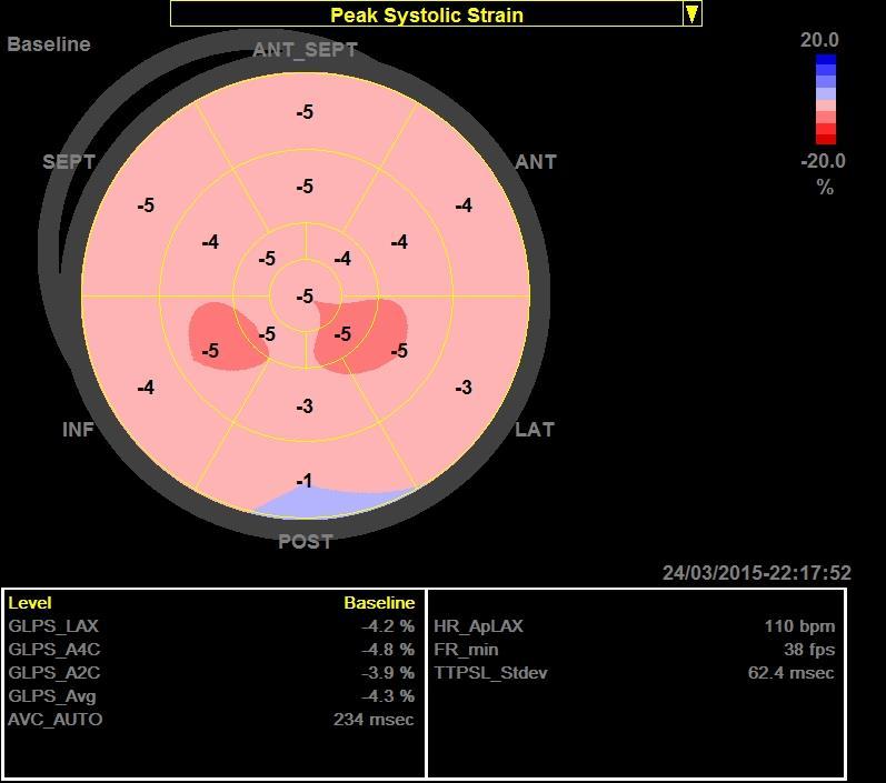 BASELINE LOW DOB F/U1 ΤΙΜΕΣ LGS < -5%