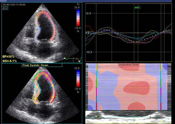anakinra injection there was an improvement in mean