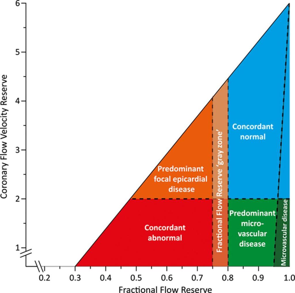 Conceptual plot of the fractional flow reserve (FFR) coronary flow velocity reserve (CFVR) relationship.