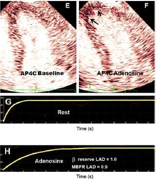Echocardiogr