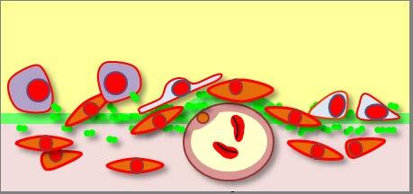 remodeling Cell