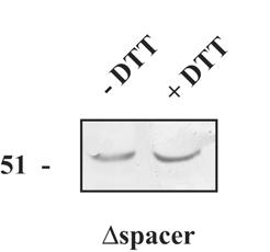 Γ.3. Έλεγχος κινητικότητας της πρωτεΐνης SRPK1 Δspacer σε SDS ηλεκτροφόρηση απουσία και παρουσία DTT.