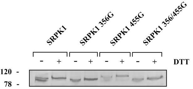 Σχήμα Γ.5. Ανοσοανίχευση των SRPK1, SRPK1 356G, SRPK1 455G και SRPK1 356/455G από εκχυλίσματα HeLa κυττάρων που είχαν επιμολυνθεί με τους αντίστοιχους πλασμιδιακούς φορεις.
