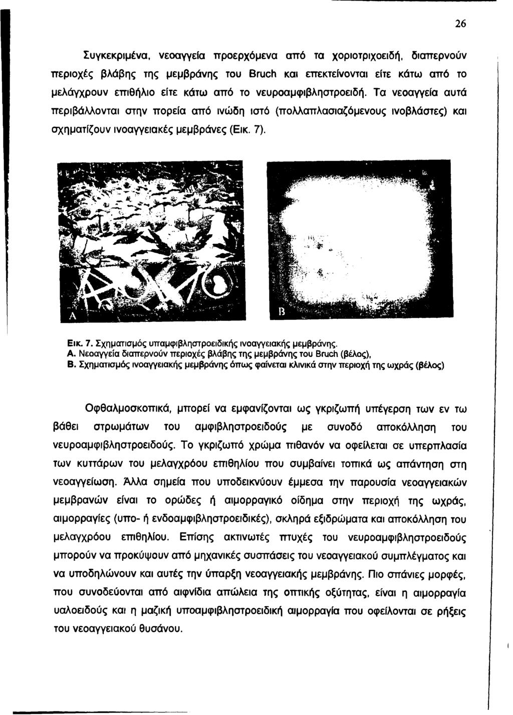 26 Συγκεκριμένα, νεοαγγεία προερχόμενα από τα χοριοτριχοειδή, διαπερνούν περιοχές βλάβης της μεμβράνης του Bruch και επεκτείνονται είτε κάτω από το μελάγχρουν επιθήλιο είτε κάτω από το