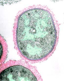 Características de Prokaryote y Eukaryote Prokaryote Eukaryote