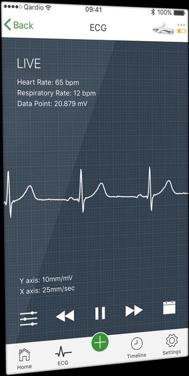 Smartphone Tele ECG Kαταγραφή