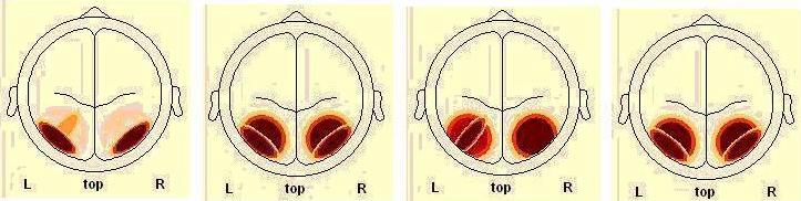 ESP5 * AROUSAL Crosstab % within AROUSAL AROUSAL LOW HIGH Total NONE 1 0,25 0,625 ESP5 HIGH 0,75 0,375 Total 1 1 1 Πίνακας [28] Πίνακας συχνότητας για την ένταση της πηγής SP5 της P1 κορύφωσης.