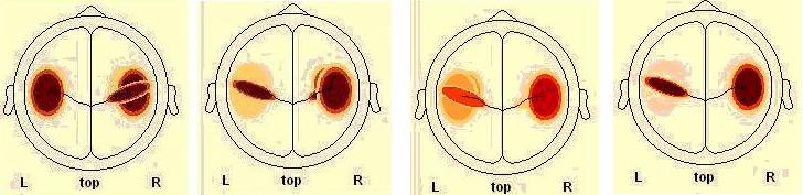 ESC3 * AROUSAL Crosstab % within AROUSAL AROUSAL LOW HIGH Total NONE 0,75 0,375 LOW 0,25 0,25 0,25 ESC3 HIGH 0,75 0,375 Total 1 1 1 Πίνακας [57] Πίνακας συχνότητας για την ένταση της πηγής SC3 της P1