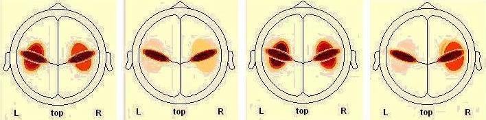 ESC5 * AROUSAL Crosstab % within AROUSAL AROUSAL LOW HIGH Total NONE 0,75 0,375 LOW 1 0,5 ESC5 MEDIUM 0,25 0,125 Total 1 1 1 Πίνακας [60] Πίνακας συχνότητας για την ένταση της πηγής SC5 της P3