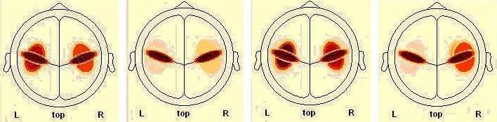 ESC5 * AROUSAL Crosstab % within AROUSAL AROUSAL LOW HIGH Total NONE 0,75 0,375 LOW 1 0,5 ESC5 MEDIUM 0,25 0,125 Total 1 1 1 Πίνακας [60] Πίνακας συχνότητας για την ένταση της πηγής SC5 της P3