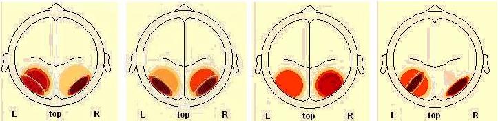 SP3 SP4 HV- άντρες HV-γυναίκες LV-άντρες LV- γυναίκες High Arousal (HA) HV- άντρες HV-γυναίκες LV-άντρες LV- γυναίκες Low Arousal (LA) Εικόνα [53] Διαφορές ως προς τη διέγερση για τις πηγές SP3,SP.