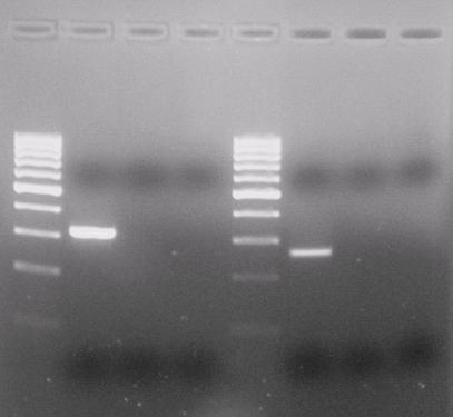 ΚΕΦΑΛΑΙΟ 3 ΑΠΟΤΕΛΕΣΜΑΤΑ 3.2 ΠΟΛΛΑΠΛΗ PCR ΓΙΑ ΤΗΝ ΤΑΥΤΟΧΡΟΝΗ ΑΝΙΧΝΕΥΣΗ ΤΩΝ ΜΙΚΡΟΟΡΓΑΝΙΣΜΩΝ Streptococcus pyogenes (Group A Streptococcus) ΚΑΙ Streptococcus agalactiae (Group B Streptococcus) 3.2.1 ΑΠΟΤΕΛΕΣΜΑΤΑ ΣΤΑΔΙΩΝ ΑΝΑΠΤΥΞΗΣ ΤΗΣ ΤΕΧΝΙΚΗΣ 1.