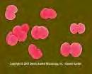 ΓΕΝΙΚΟ ΜΕΡΟΣ ΚΕΦΑΛΑΙΟ 1 ΕΙΣΑΓΩΓΗ 1.2.5 Streptococcus pneumoniae (Πνευμονιόκοκκος) 1.2.5.1 Δομή και γενικά χαρακτηριστικά Ο μικροοργανισμός Streptococcus pneumoniae (πνευμονιόκοκκος) παρουσιάζεται με τη μορφή διπλοκόκκων μεγέθους 0.