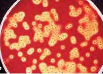 ΓΕΝΙΚΟ ΜΕΡΟΣ ΚΕΦΑΛΑΙΟ 1 ΕΙΣΑΓΩΓΗ 1.2.6 Streptococcus pyogenes (Group A Streptococcus) 1.2.6.1 Δομή και γενικά χαρακτηριστικά Ο μικροοργανισμός Streptococcus pyogenes παρουσιάζεται με τη μορφή κόκκων μεγέθους 0.