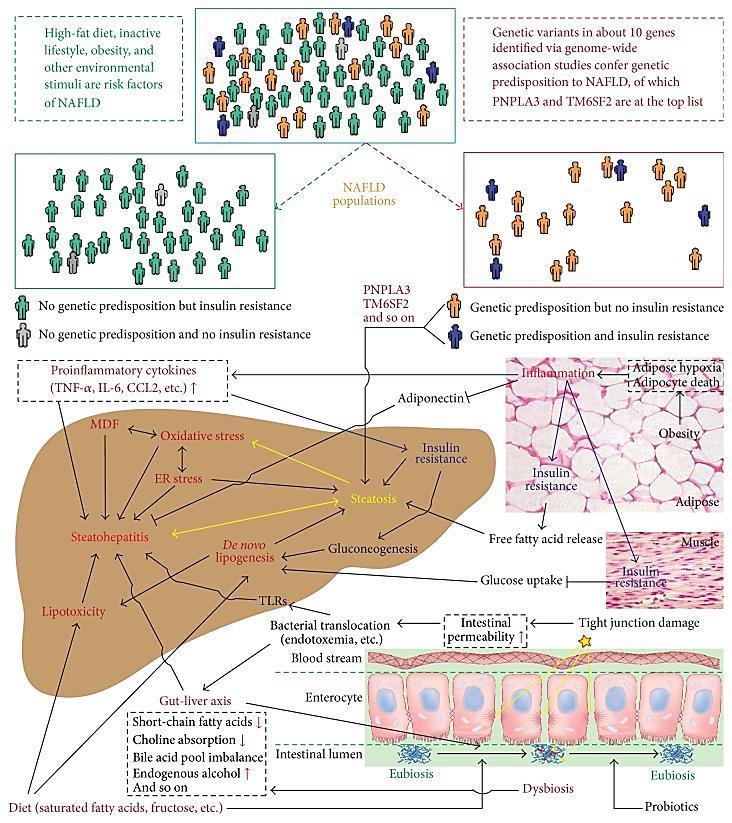 ρήκα 1.4.1.1. H παεμβέκεζα ηδξ NAFLD.