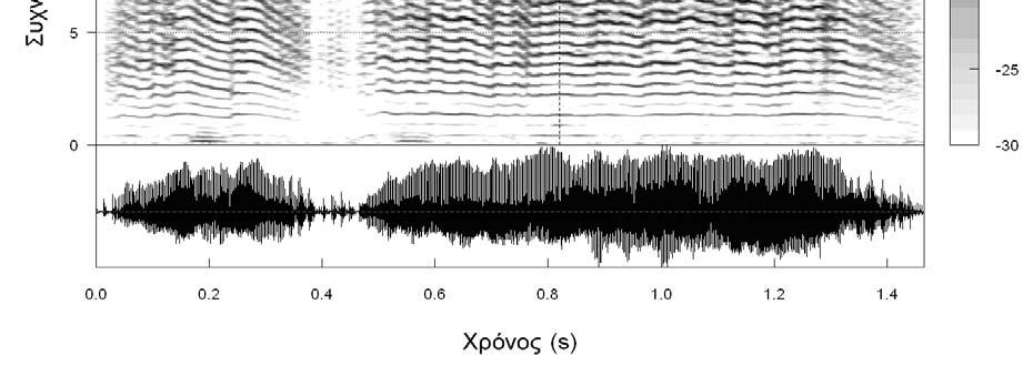 (b) φασματογράφημα (συχνότητα σε σχέση με το χρόνο και με το σχετικό εύρος σε decibel) και παλμική καταγραφή (σχετικό εύρος σε σχέση με το χρόνο).