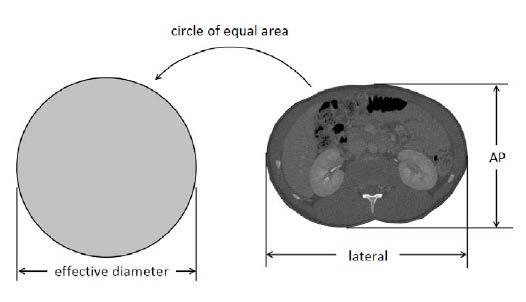 Size Specific Dose Estimate (SSDE) AAPM Report 204, 2011 SSDE: χρησιμοποιεί Παράγοντες Μετατροπής που εξαρτώνται από τις διαστάσεις του ασθενούς για την μετατροπή του CTDI vol σε εκτιμώμενη δόση στον