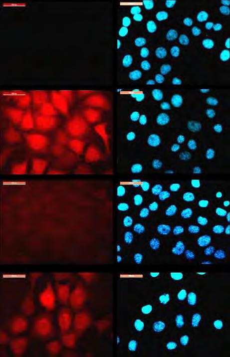 control hypoxia TNFα hypoxia+ TNFα anti-hif-1α DAPI Εικ.