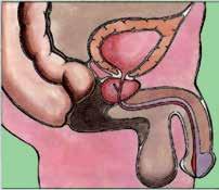 Zgradba in delovanje prostate Prostata, imenovana tudi obseënica, je organ velikosti oreha, ki pri moπkih leæi neposredno pod seënim mehurjem in obdaja seënico.