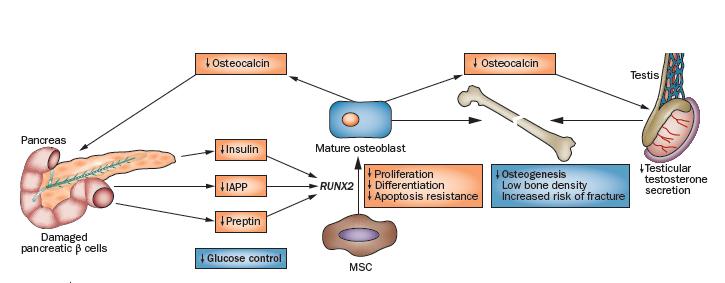 Σχέση οστικού µεταβολισµού και β-κυττάρου PancreaEc β-cell destruceon in paeents with DM prevents secreeon of insulin, IAPP and prepen, thereby reducing their effects on the RUNX2 gene.
