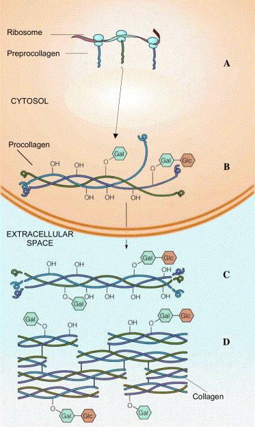 Advanced Glycation End products µπορεί να ελαττώσουν την οστική αντοχή Μπορεί να ελαττώσουν pyridinium crosslinks1 Μειώνουν τις µηχανικές ικανότητες του