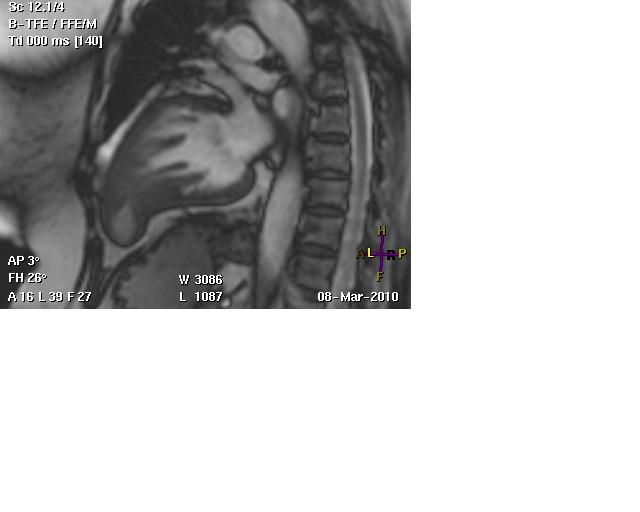 Apical