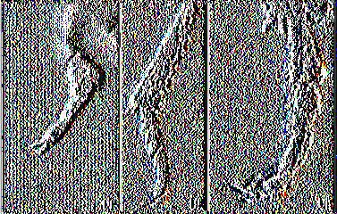 δικρανοειδή απόφυση (Μπουχέλος 1996).