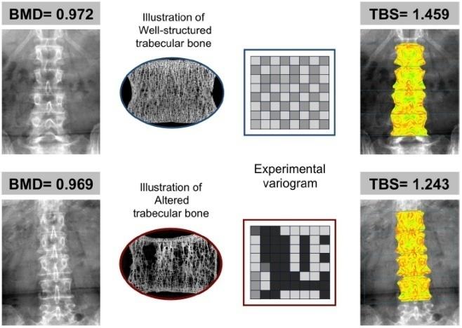 TBS, GE-Lunar Report TBS, Hologic Report