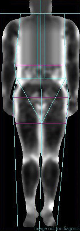 Technical Aspects of Positioning and