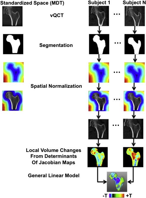 4) Tensor-based morphometry (TBM-QCT): ü ü ü Μοντέλα ογκοµετρικής µελέτης παραµορφώσεων (voxel-shaped) Ανάλυση µακροσκοπικής ανατοµίας Χαρτογράφηση