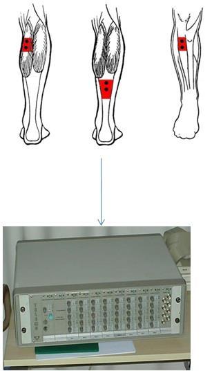 ΗΜΓ (τοποθέτηση ηλεκτροδίων) και ηλεκτροερεθισμός Τοποθέτηση ηλεκτροδίων σύμφωνα με Basmanjan and Blumenstein (1983) Μέτρηση δραστηριότητας αγωνιστών και ανταγωνιστών μυών