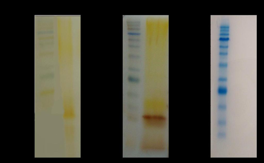 ΛΛΡΟΡΟΛΥΣΑΚΧΑΛΤΕΣ ΤΘΣ Pseudomonas sp. Α) Θ απομόνωςθ των λιποπολυςακχαριτϊν (LPS) από τθ βακτθριακι μεμβράνθ τθσ Pseudomonas sp. ζγινε με τθ μζκοδο των Eidhin και Mouton (Eidhin and Mouton, 1993).