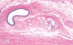 limfne æile vena lamina proprija arteriola muskularis mukoze Sl.