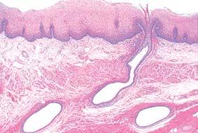 esophagea gusto vezivno tkivo Sl. 153.