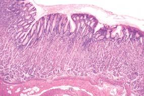 bazalni dio æeluëane ælijezde muskularis mukoze vena podsluznica arterija