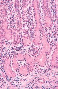 proprija piloriëke ælijezde piloriëke ælijezde arteriola