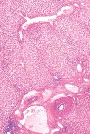 vena limfne æile interlobularne arterije æuëni kanaliê vezivno tkivo uπêe sinusoida u srediπnju