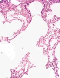 bronhalne arterije terminalni bronhiol respiracijski