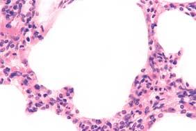 alveolarna vreêica interalveolarna pregrada ogranak bronhalne arterije Sl.
