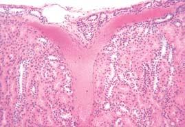 Bubreg kora arteria arcuata sræ vena arterija bubreæni hilus bubreæna (sræna)