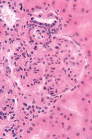 kapilarna mreæa glomerularne kapilare mokraêni prostor parijetalni list Bowmanove Ëahure distalni